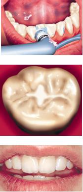 Prophylaxe statt Behandlung 2